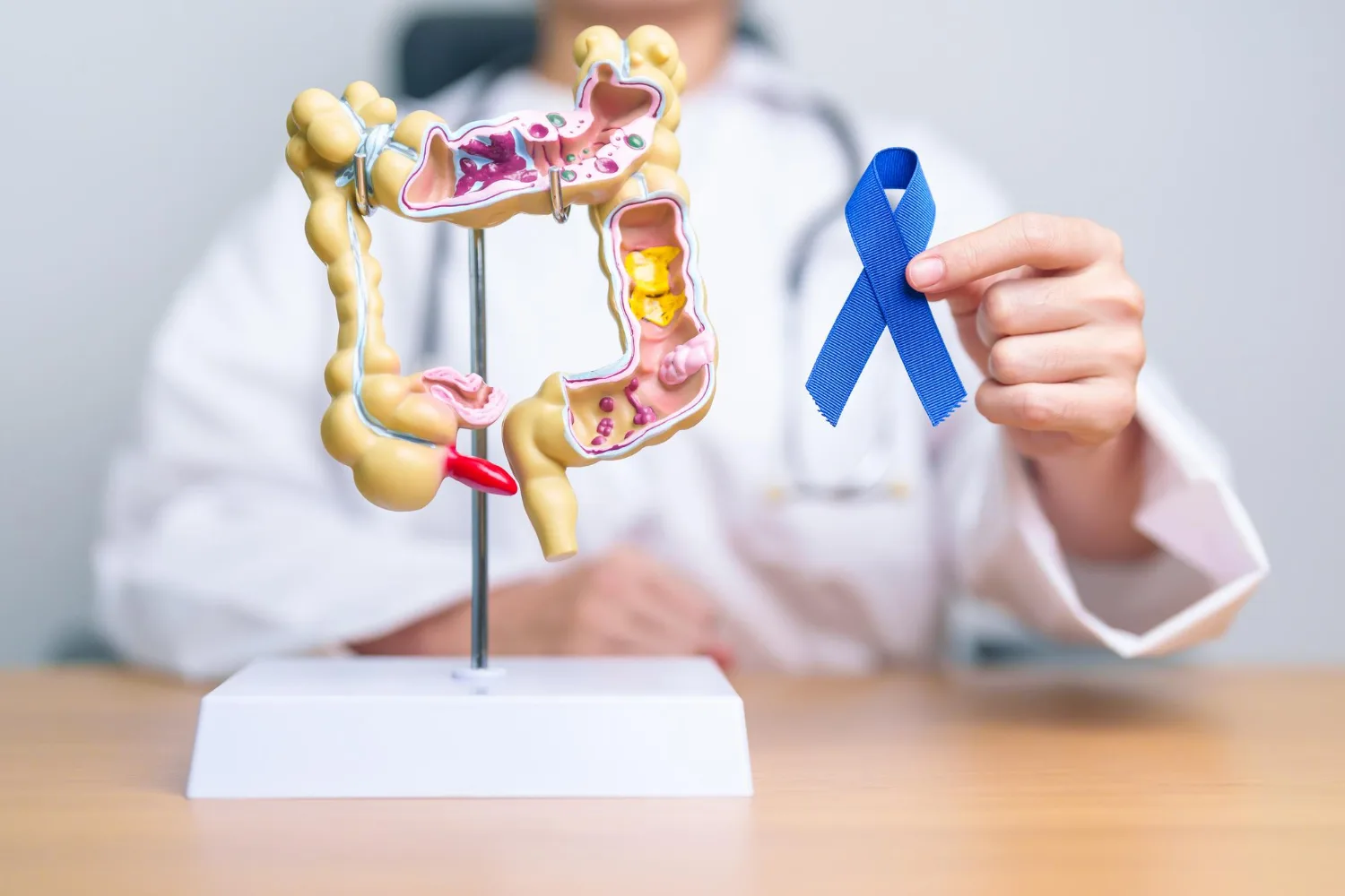 Detección temprana de Cáncer Colorrectal en Juriquilla y San Juan del Río